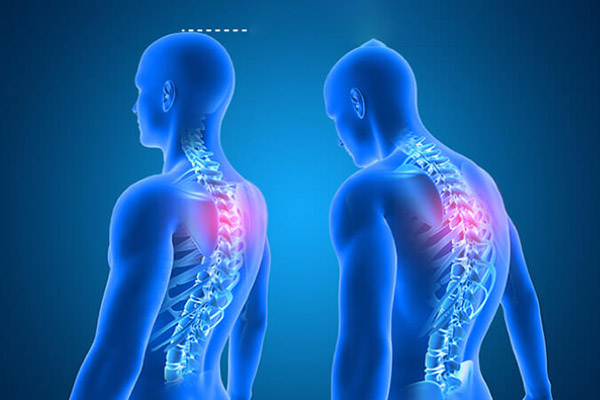 Can A Chiropractor Make You Taller?